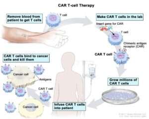 Best Guide to CAR T Cell Therapy in India | Cost, Procedure 2025