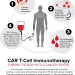 Beat Leukemia with CAR-T: A Revolutionary Leap in Blood Cancer Treatment