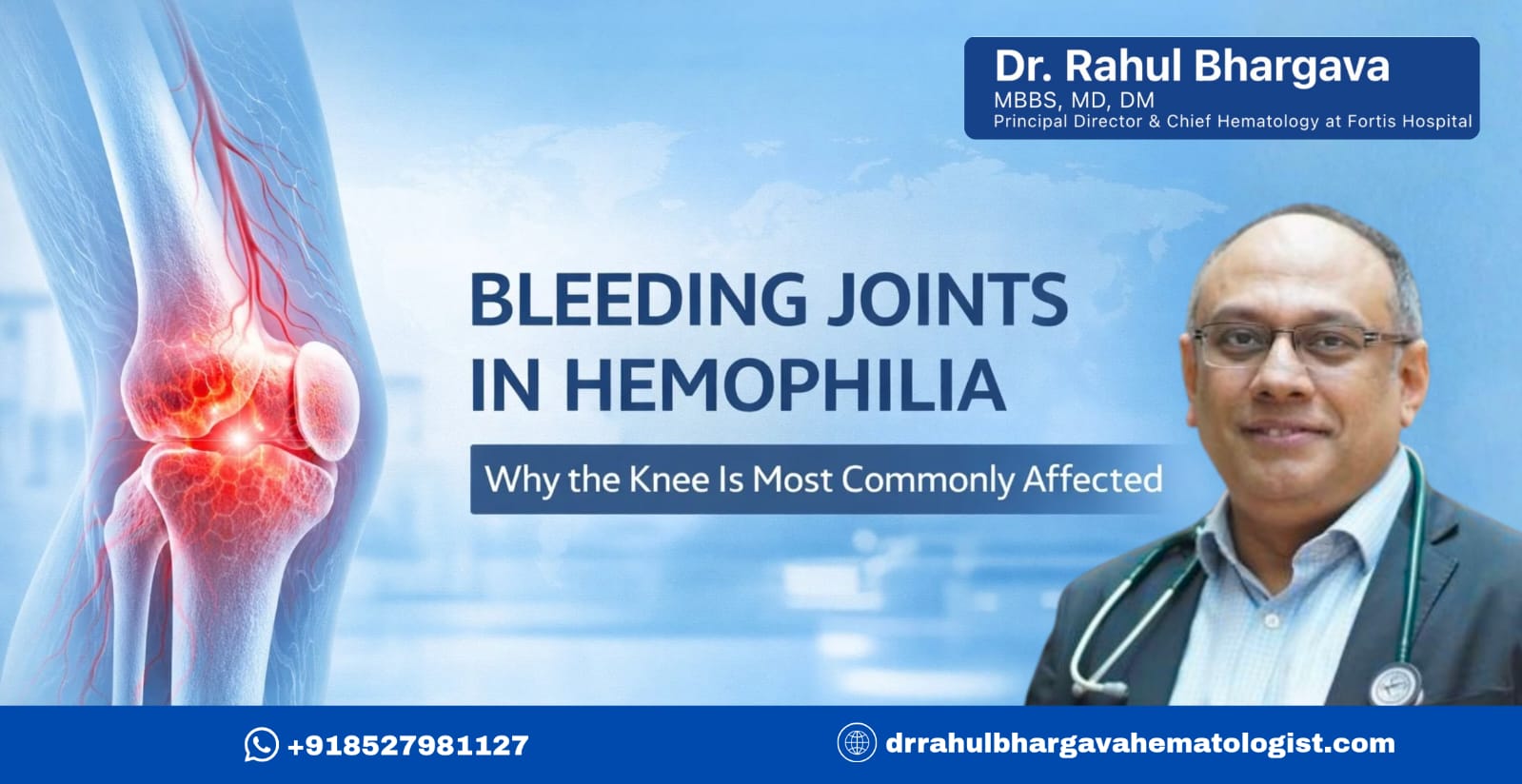 Bleeding Joints in Hemophilia: Why the Knee Is Most Commonly Affected