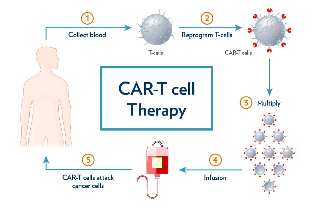 CAR-T cell therapy Cost in India