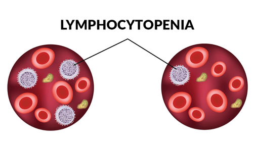 Lymphocytopenia Treatment Cost in India