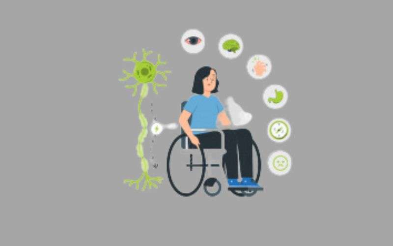 Multiple Sclerosis Treatment