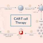 car t cell therapy