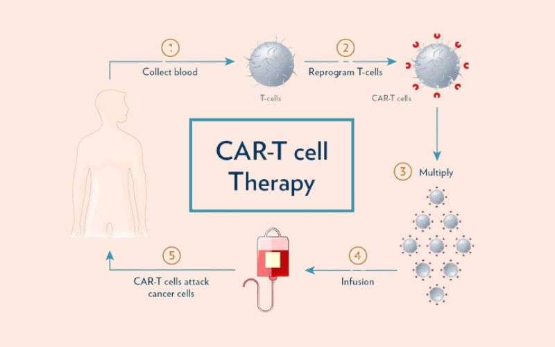 car t cell therapy